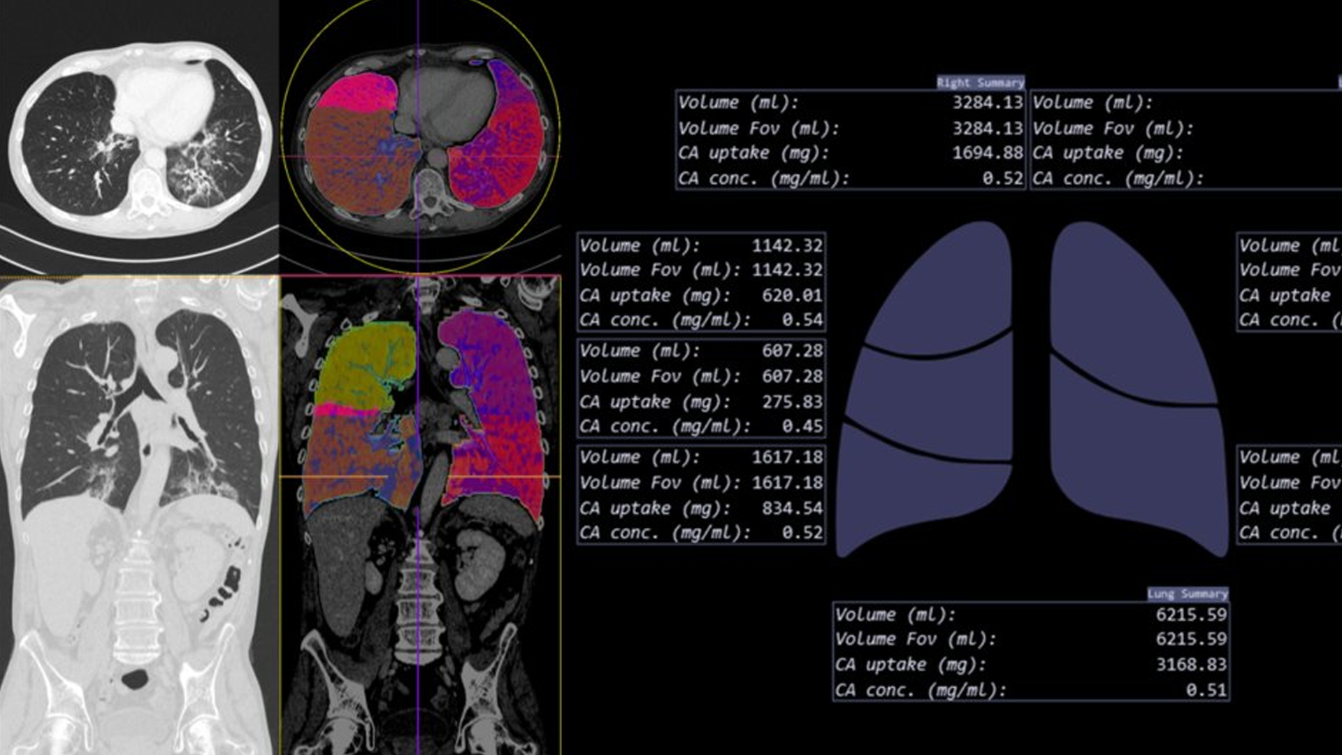 COVID-19 CT Image Analysis preview